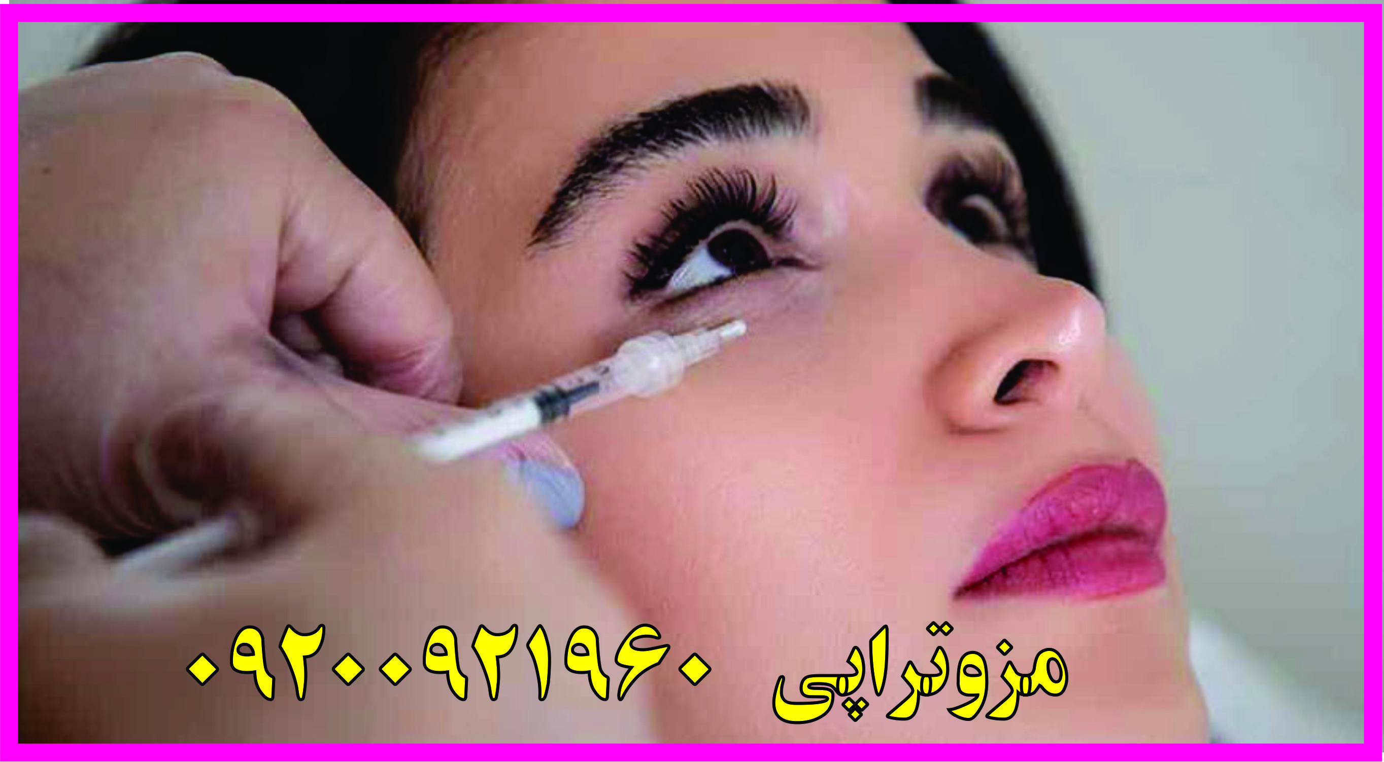 مرکز اصلی لیزر موهای زائد