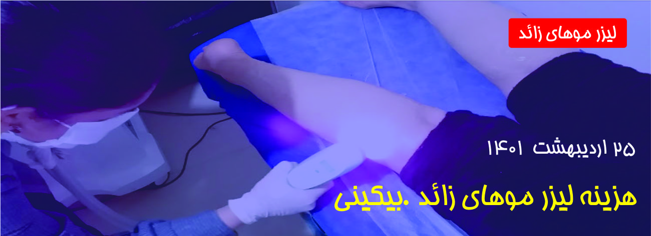 مرکز لیزر موهای زائد در غرب تهران